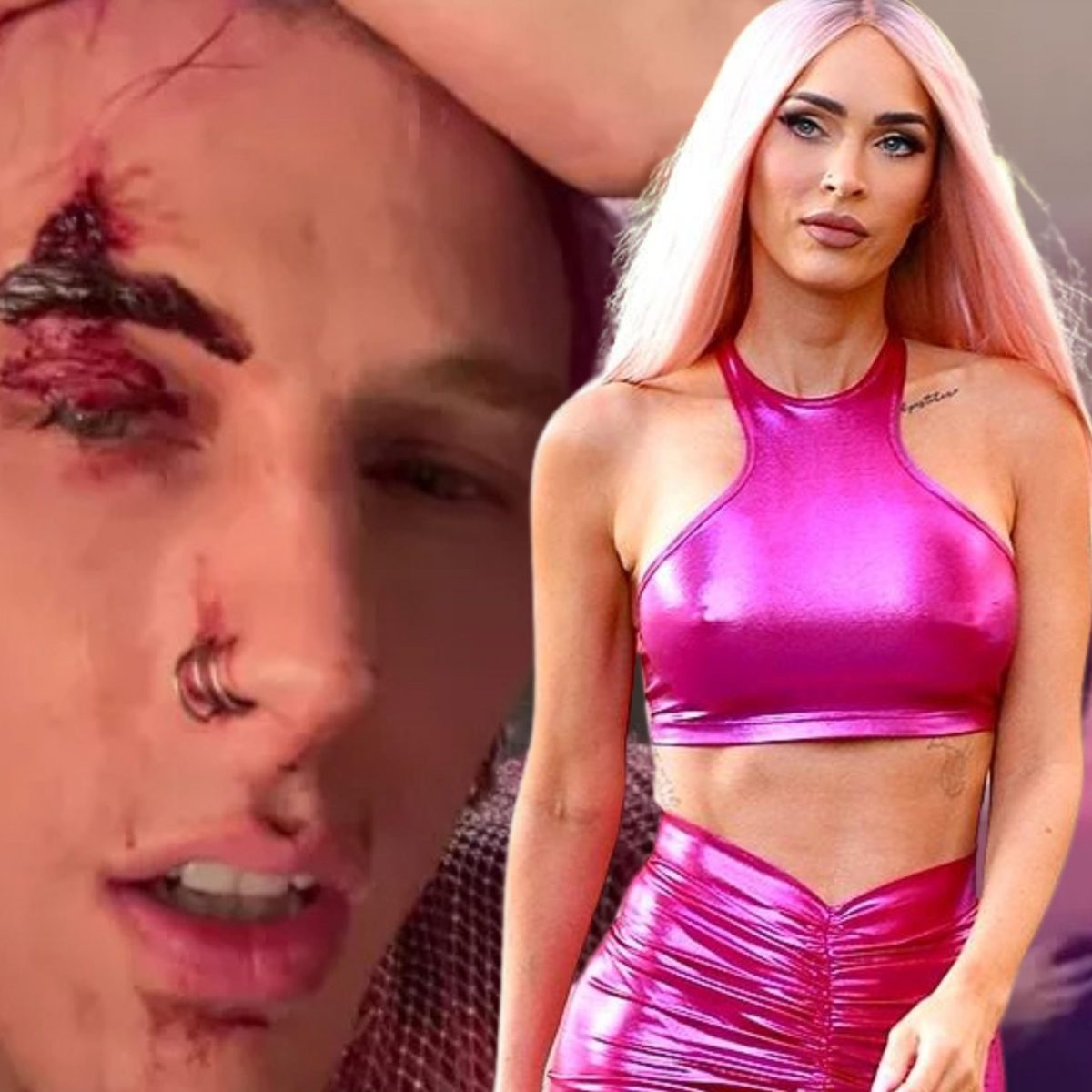 Γεμάτος αίματα βγήκε ο σύντροφος της Μέγκαν Φοξ μετά τη συμμετοχή του σε ξέφρενο πάρτι!