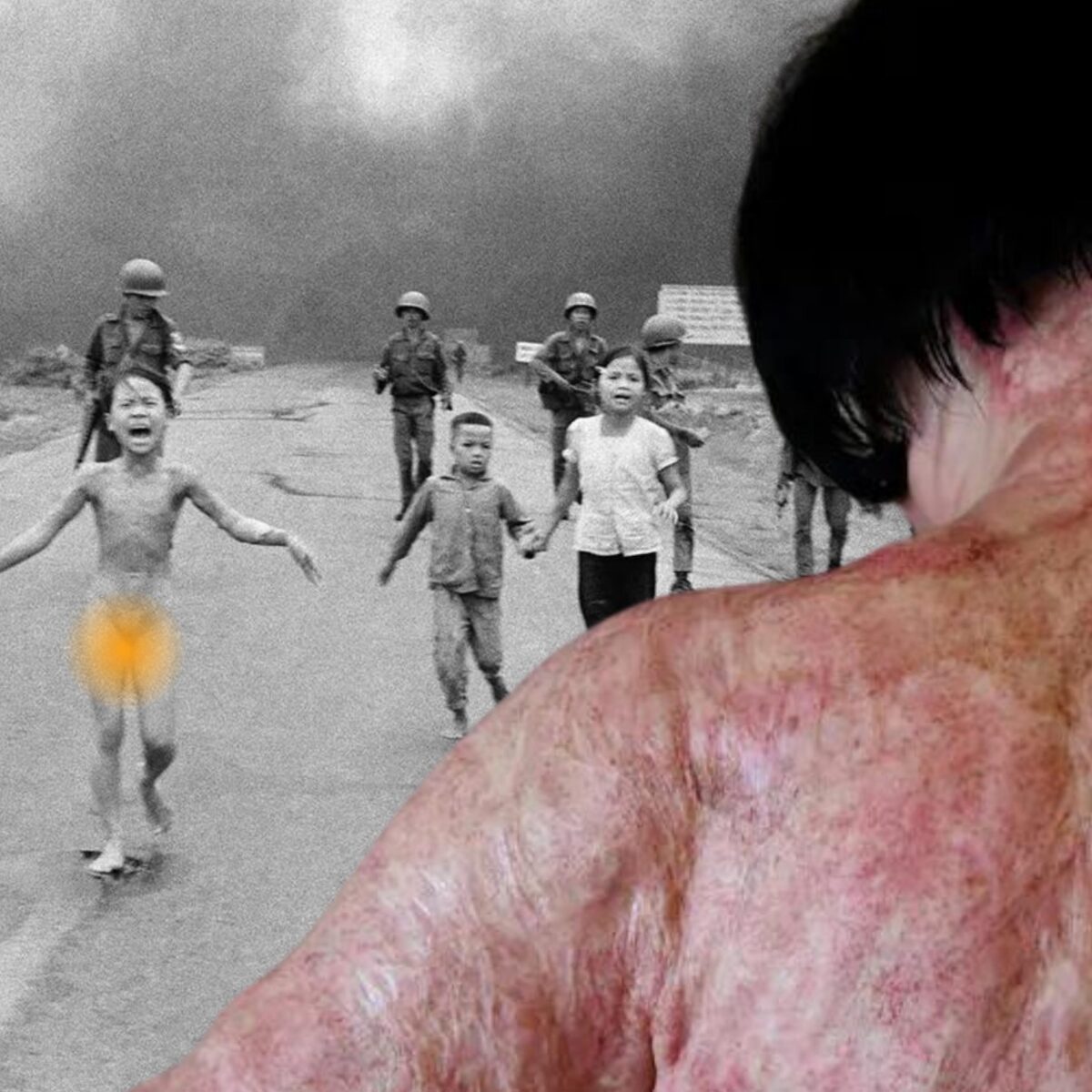 Πώς δείχνει σήμερα το γυμνό κορίτσι αυτής της σπαρακτικής φωτογραφίας;