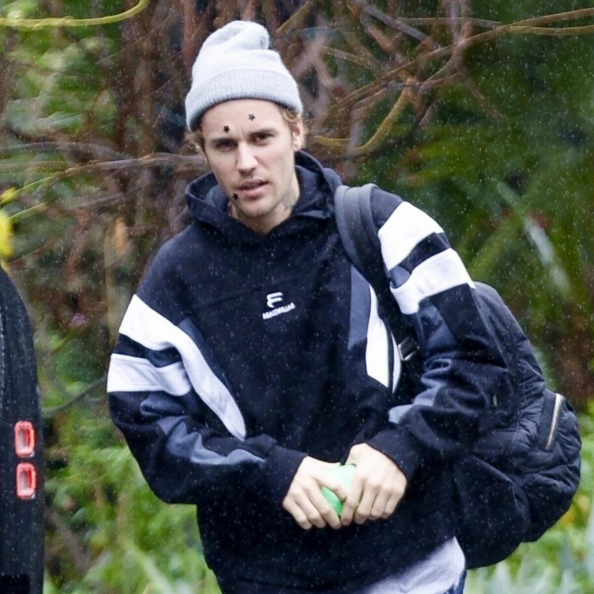 Τζάστιν Μπίμπερ: Πήγε σε ηχογράφηση με ανησυχητικά σπυριά στο πρόσωπο που στην πραγματικότητα ήταν trendy καλύμματα ακμής!