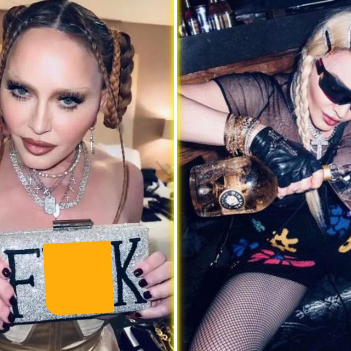 Η Μαντόνα αναγκάστηκε να μιλήσει για το πρόσωπό της στα Grammys: Που ρίχνει ευθύνες