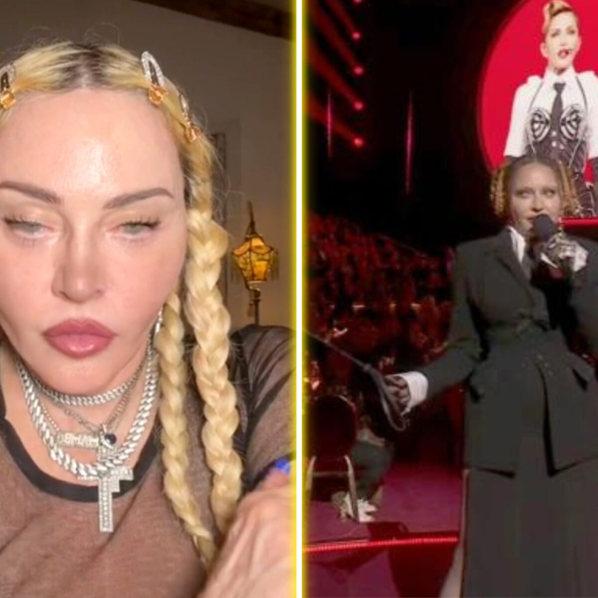 Σκάνδαλο με το πρόσωπο της Μαντόνα στα Grammys: Η τρομακτική αλλαγή και oι πλαστικές επεμβάσεις για τις οποίες μιλούν οι φαν
