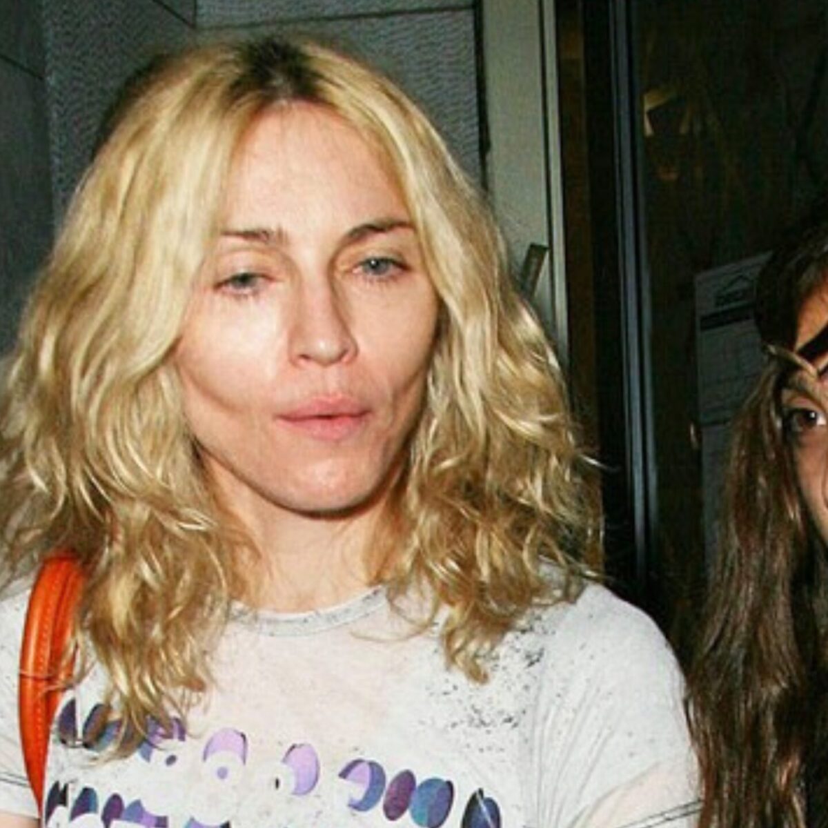 Xειροτέρευσε η υγεία της Μαντόνα: Tι συμπτώματα της έχει προκαλέσει η βακτηριακή μόλυνση